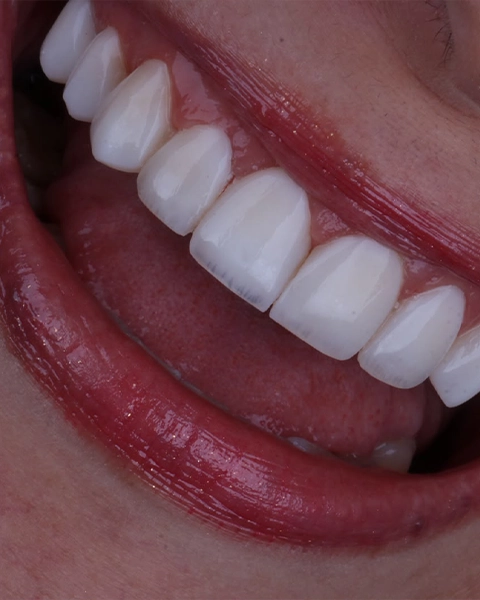 draleticia antes e depois 02