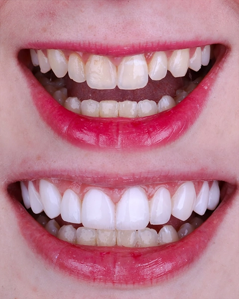 draleticia antes e depois 03