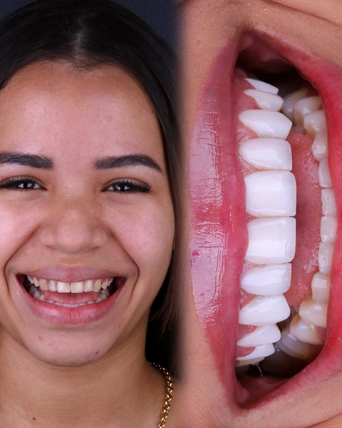 draleticia antes e depois 04