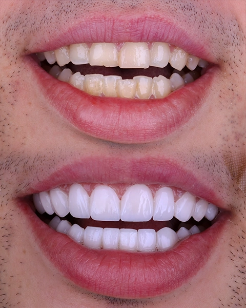 draleticia antes e depois 06
