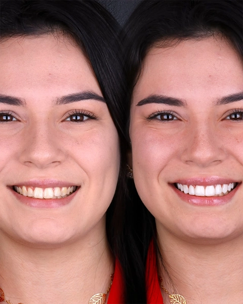 draleticia antes e depois 07